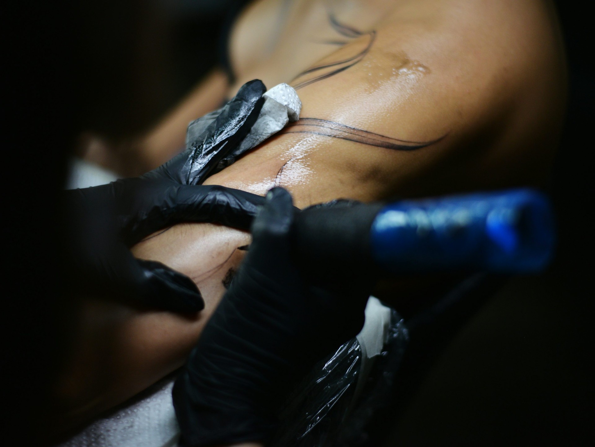 OnDerma 2
