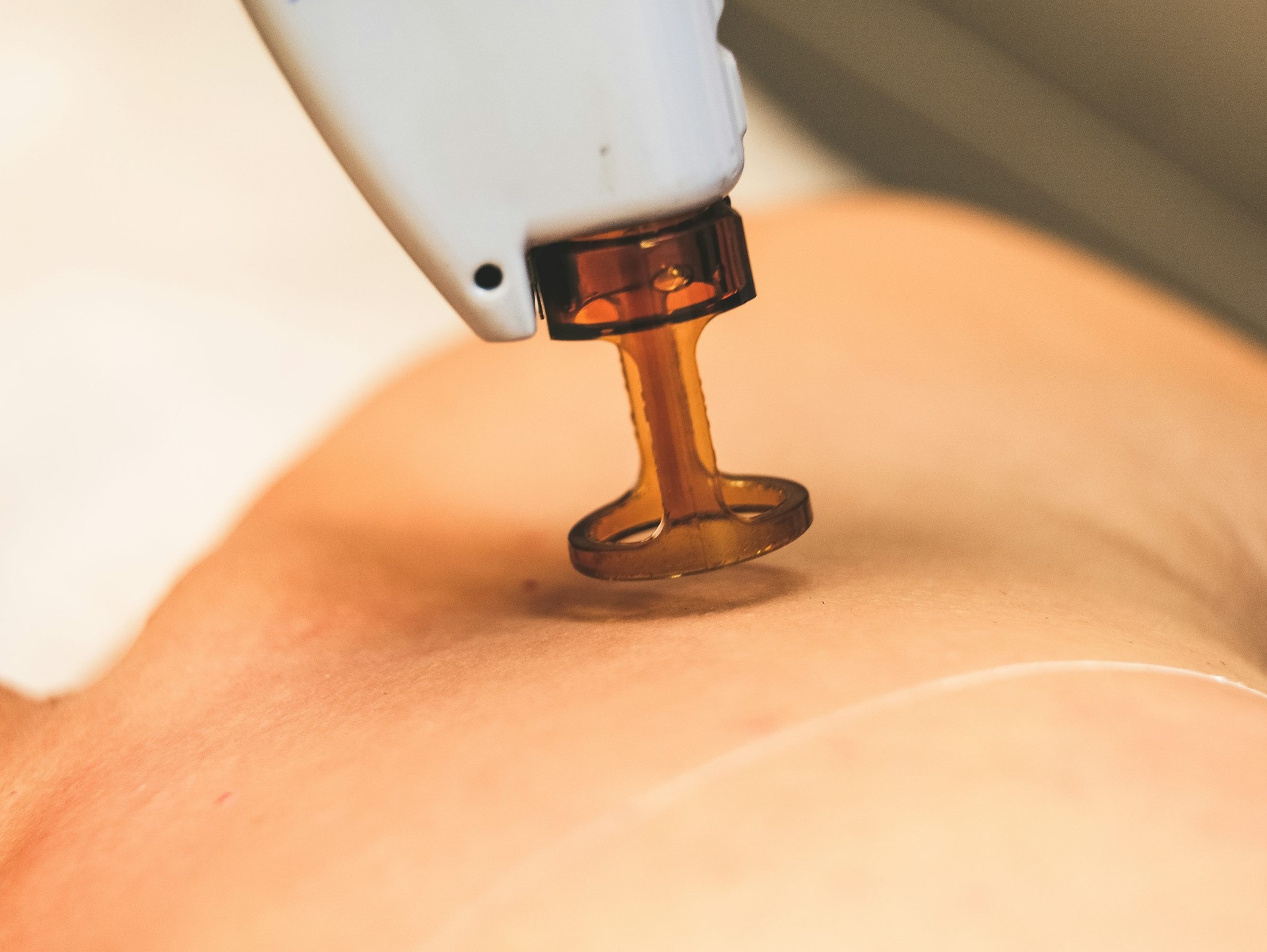OnDerma 3